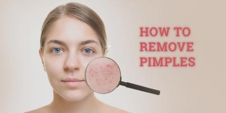 How to get rid of pimples